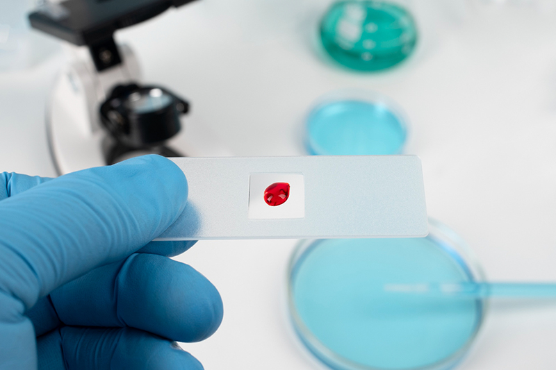 A close-up image of a hand in a blue medical glove holding a microscope slide with a tiny amount of blood on it.