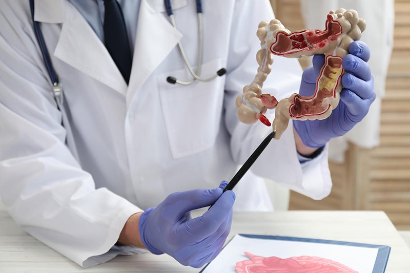Unidentified medical provider holds a model of the intestines and colon using a pen to point at it.
