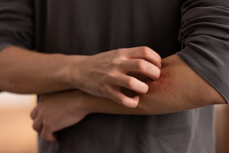 Unidentifiable male scratching his lower left arm with his right hand.