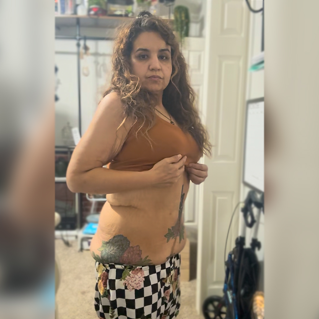 Grissela Bustamante at home showing her excess skin around her mid-section from her weight loss journey