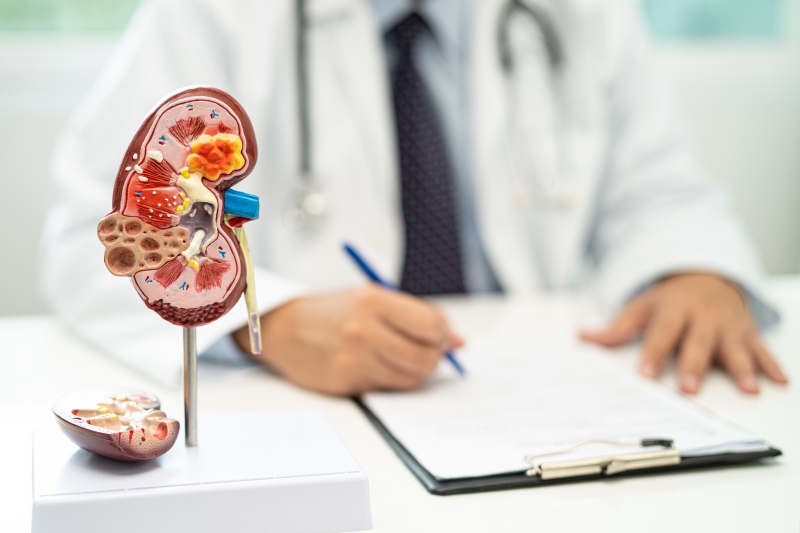 A medical model of a kidney sitting on a desk with an out of focus doctor seated at the desk writing on a piece of paper on a clipboard