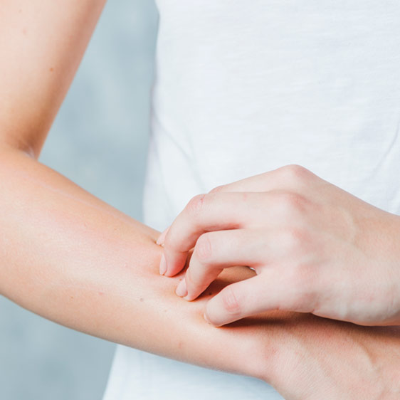 Person scratching a bug bite