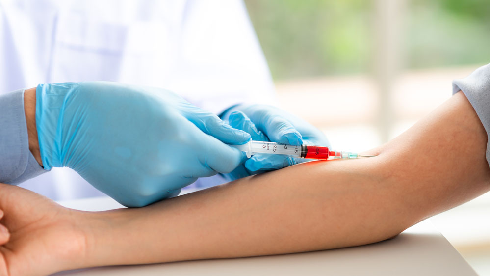 Liver Diesease