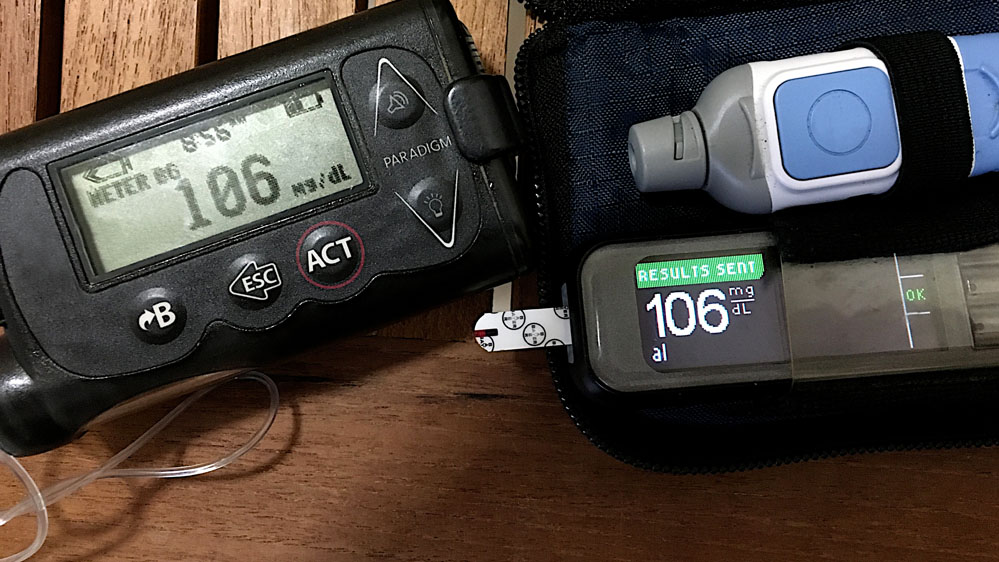 Type 1 Diabetes