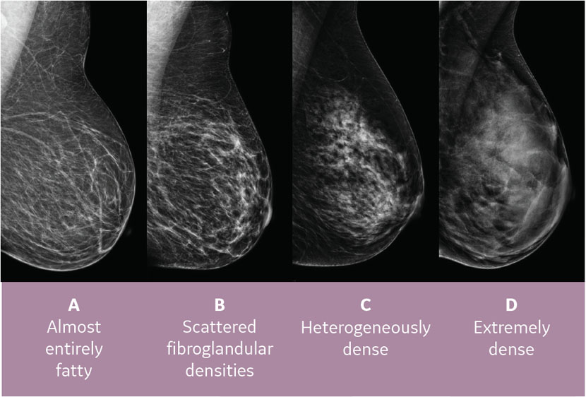 breast density grading